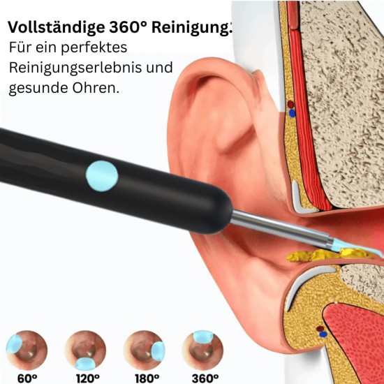 Intelligenter wasserdichter visueller Ohrenschmalzentferner