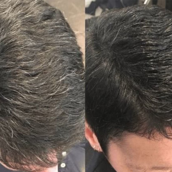 Zeitlich begrenzt 50 % RabattShampoo zum sofortigen Frben der Haare